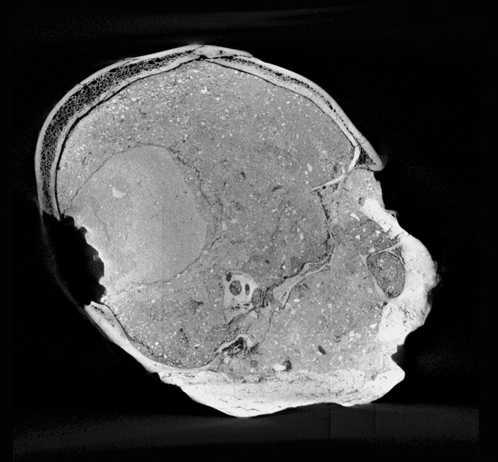 Recreating the Face of a 9,500YearOld Man